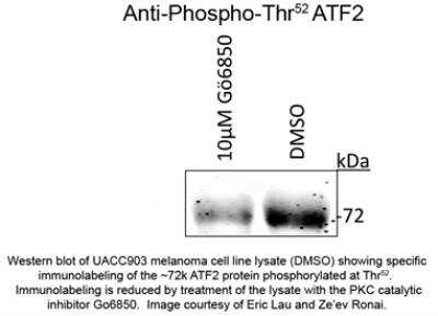 Western Blot: ATF2 [p Thr52] Antibody [NBP2-29528]